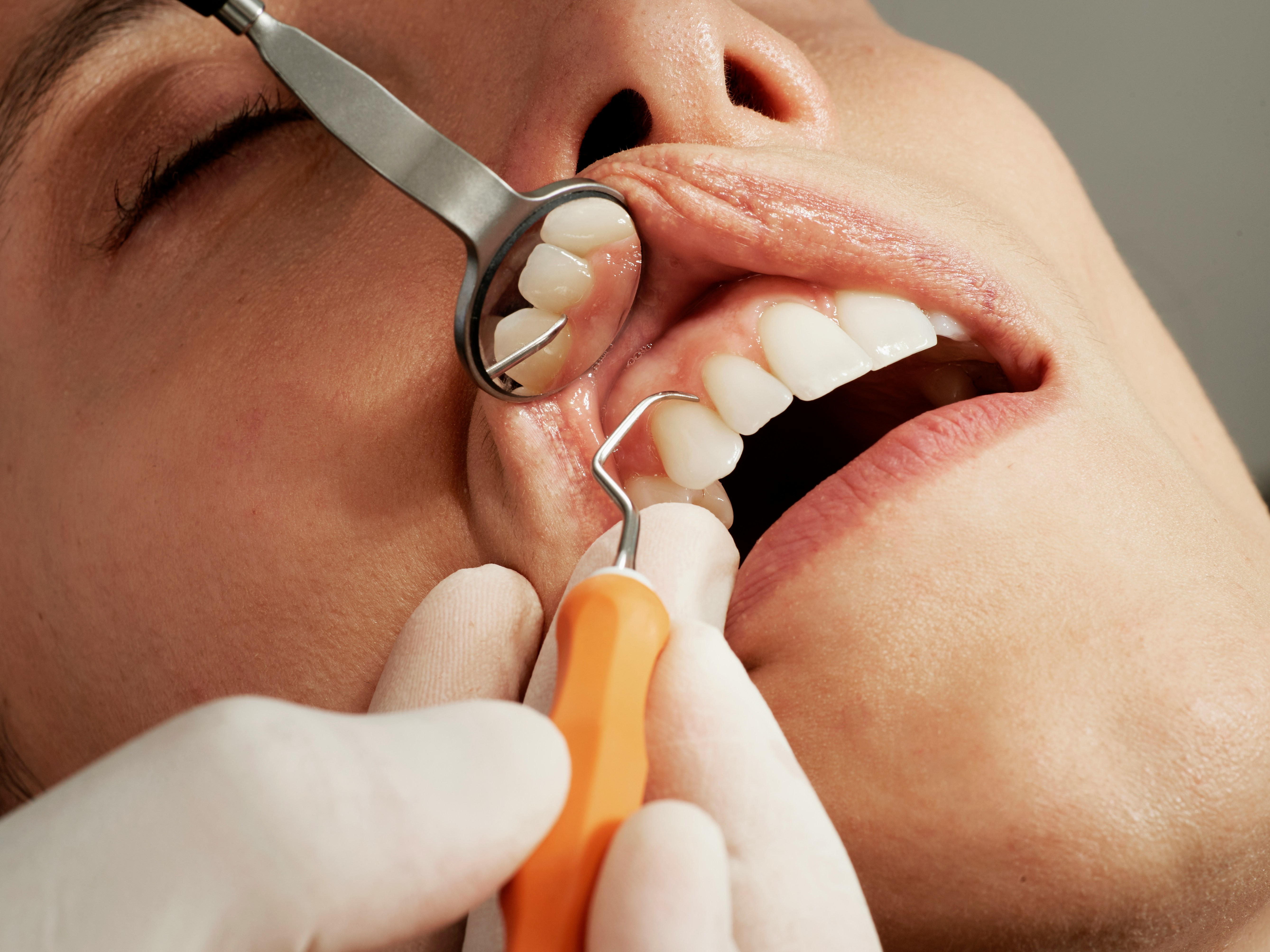 Patient on dental chair